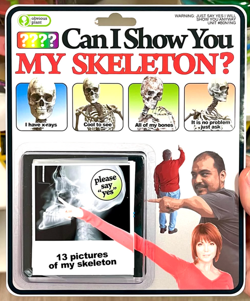 Toy Prototypes (2025)
